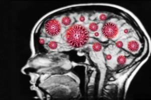 新研究发现新冠病毒能直接侵入大脑导致患者神志不清