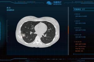 新泰市中医医院启用肺癌早期筛查