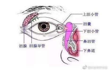 有一种肿泡眼叫做泪腺脱垂